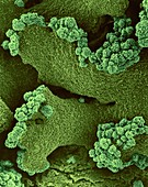 Crustose lichen Xanthomendoza fallax, SEM