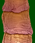 Tapeworm proglottids (Taenia pp.), SEM