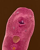 Dog fluke (trematode), SEM