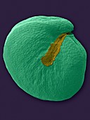 Quinoa seed (Chenopodium quinoa), SEM