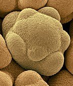 Flower bud in a cauliflower head, SEM