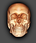 Human skull, 3D CT scan