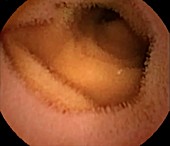 Normal small intestine, capsule endoscope view