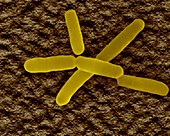 Soil bacterium (Bradyrhizobium sp.), SEM