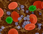 Red blood cells, monocytes, platelets and fibrin, SEM