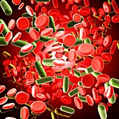 Bacterial blood infection, illustration