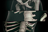 Human vertebrae