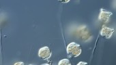 Vorticella peritrich ciliates, LM