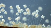 Vorticella peritrich ciliates, LM