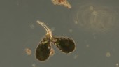 Difflugia testate amoeba