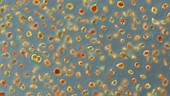 Haematococcus algae bloom, LM