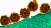 Herpes simplex virus, TEM