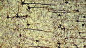 Brain pyramidal neurons, LM