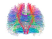 White matter fibres of the human brain
