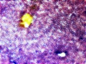 Liver tissue, light micrograph