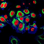 HeLa cervical cancer cells, fluorescence light micrograph