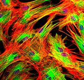 Fibroblast skin cells, fluorescence light micrograph