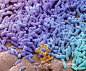 Bacteria found on dishcloth, SEM