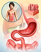 Child's stomach and intestinal villi, illustration