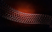 Carbon nanotube, illustration