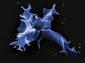 Parasitic amoeba, SEM