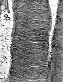 Retina rod cell, TEM
