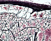 Lymph node reticular fibres, light micrograph