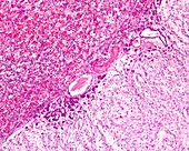 Intermediate lobe of the pituitary gland, light micrograph