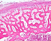 Embryonic bone, light micrograph