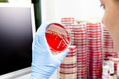 Microbiologist examining an agar plate