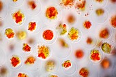 Haematococcus algae, light micrograph