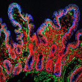 Small intestine villi, light micrograph