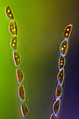 Cymbella diatoms, light micrograph
