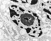 Nucleus from a glial cell, TEM