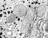 Cellular organelles from a liver cell, TEM