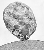 Plasmodium falciparum, TEM