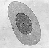 Human erythroblast, TEM