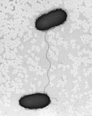 E. coli conjugation, TEM