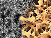 Bone structure and nanomaterial, artwork