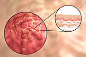 Oesophagus wall, light micrograph and illustration