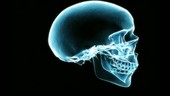Skull X-Ray 2