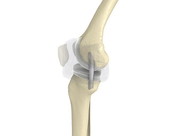 Knee Joint 1