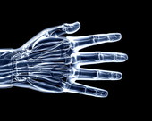 X-ray Hand