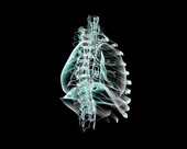 Respiratory System X-ray 2