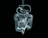 Digestive System X-ray 1