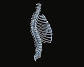 Ribs Spine X-Ray 2