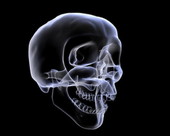 Skull X-Ray 4