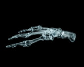 Foot Bones X-Ray 2
