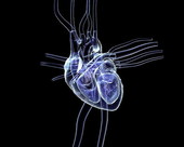 Heart X-Ray 2