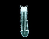 X-ray Erecting Penis